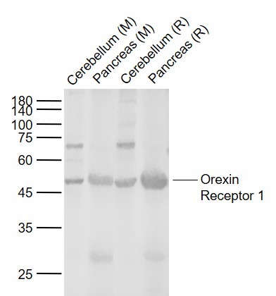 Anti-OX1R Polyclonal Antibody