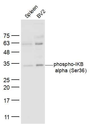 Anti-Phospho-IkB alpha/NFKBIA (Ser36) Polyclonal Antibody