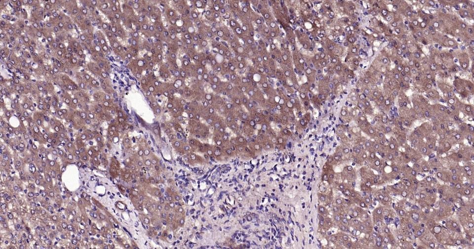 Anti-ox-LDL Antibody (4W894)