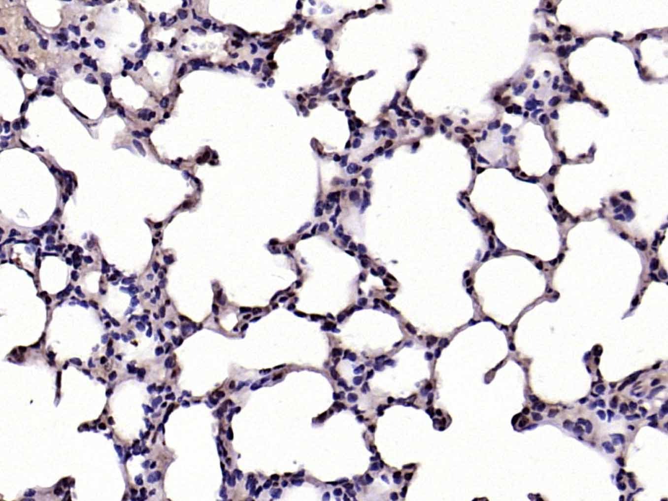 Anti-Phospho-IkB alpha/NFKBIA (Ser32, 36) Polyclonal Antibody