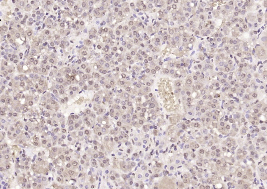 Anti-Phospho-IkB alpha/NFKBIA (Tyr305) Polyclonal Antibody