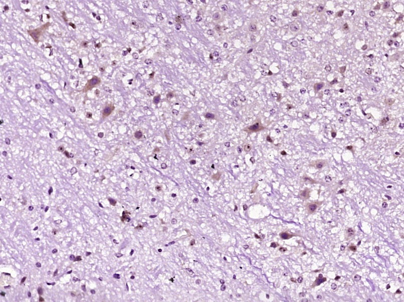 Anti-OX1R/OX2R Polyclonal Antibody