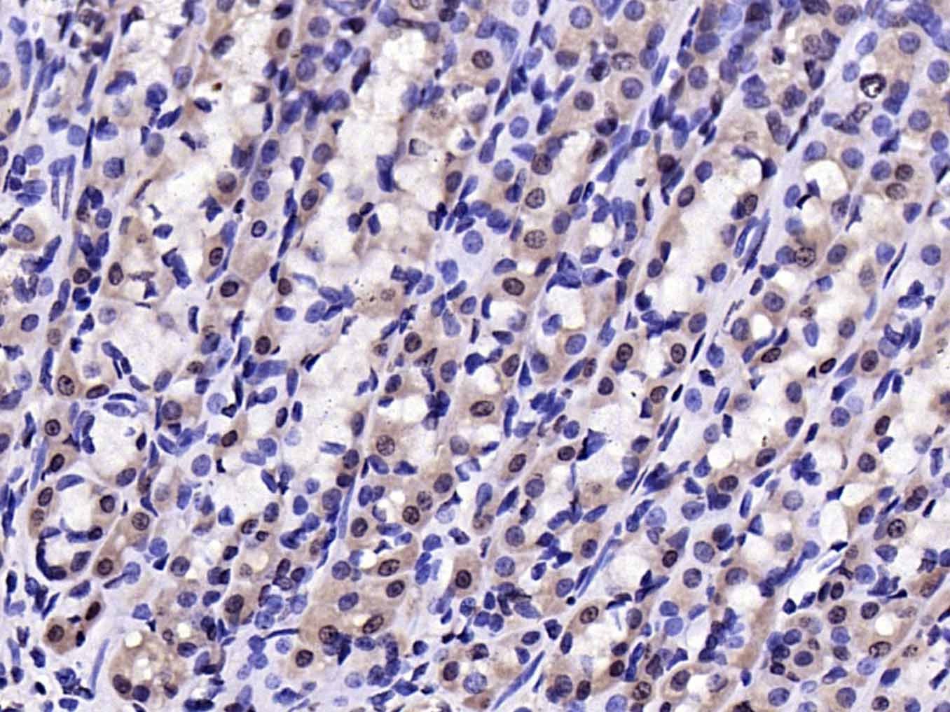 Anti-Phospho-IkB alpha/NFKBIA (Tyr305) Polyclonal Antibody