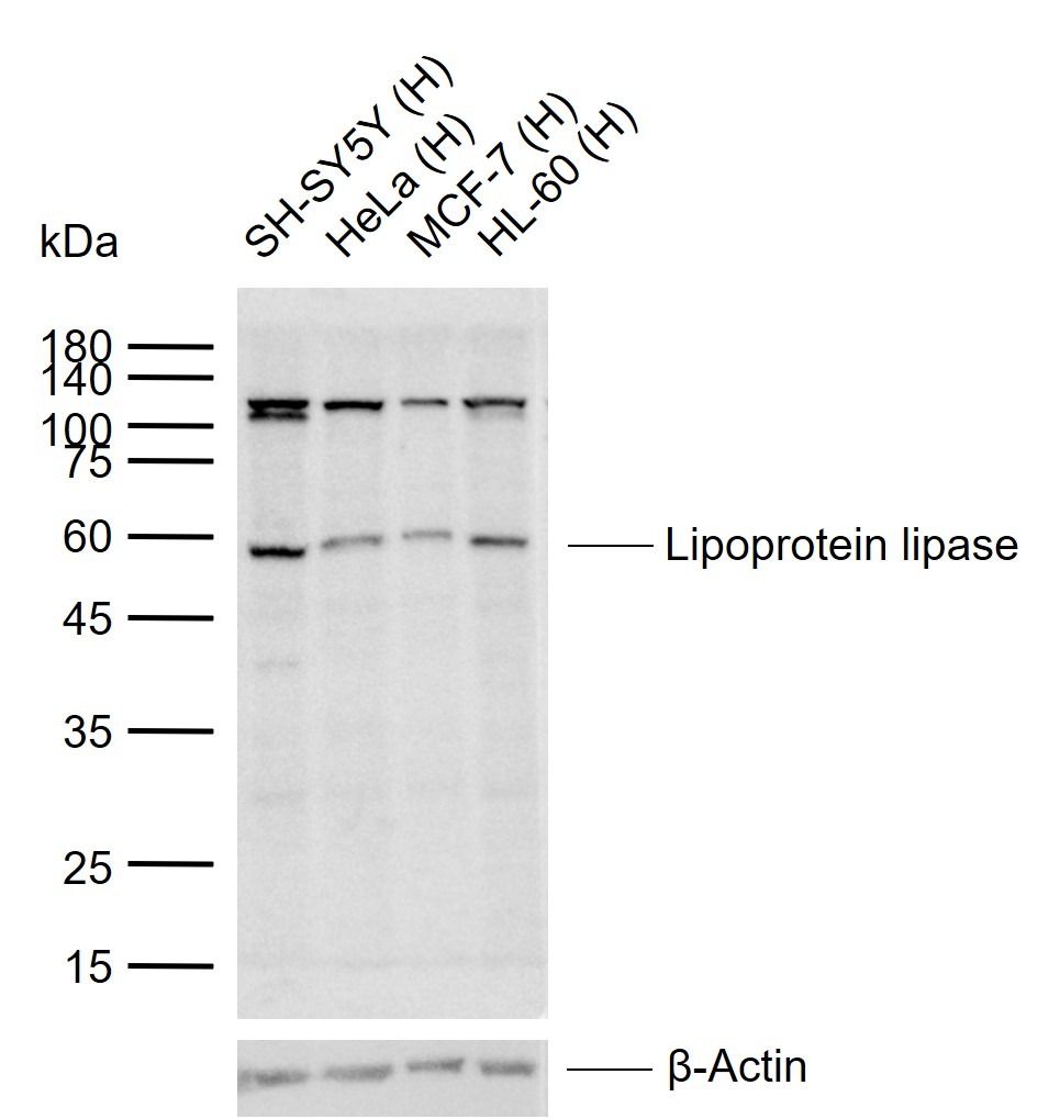 Anti-Lipoprotein lipase Polyclonal Antibody 2