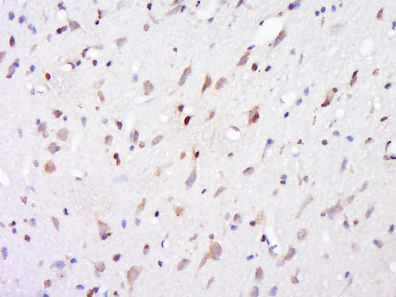 Anti-Lipoprotein lipase Polyclonal Antibody 2