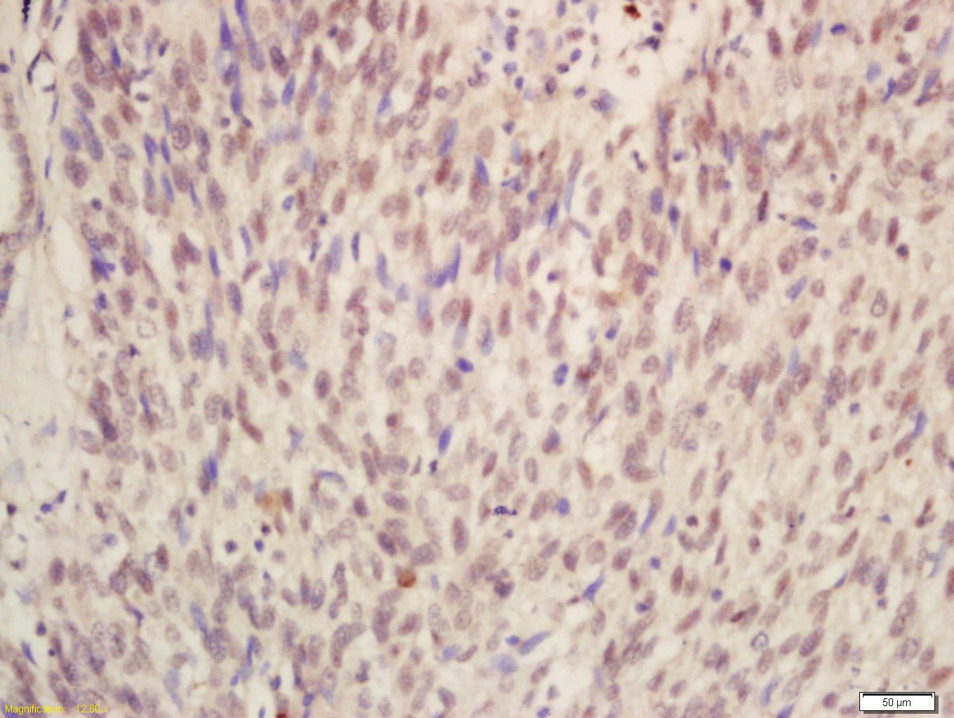 Anti-METTL14 Polyclonal Antibody