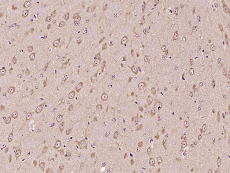 Anti-Lp-PLA2/PLA2G7 Polyclonal Antibody