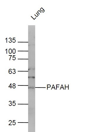 Anti-Lp-PLA2/PLA2G7 Polyclonal Antibody