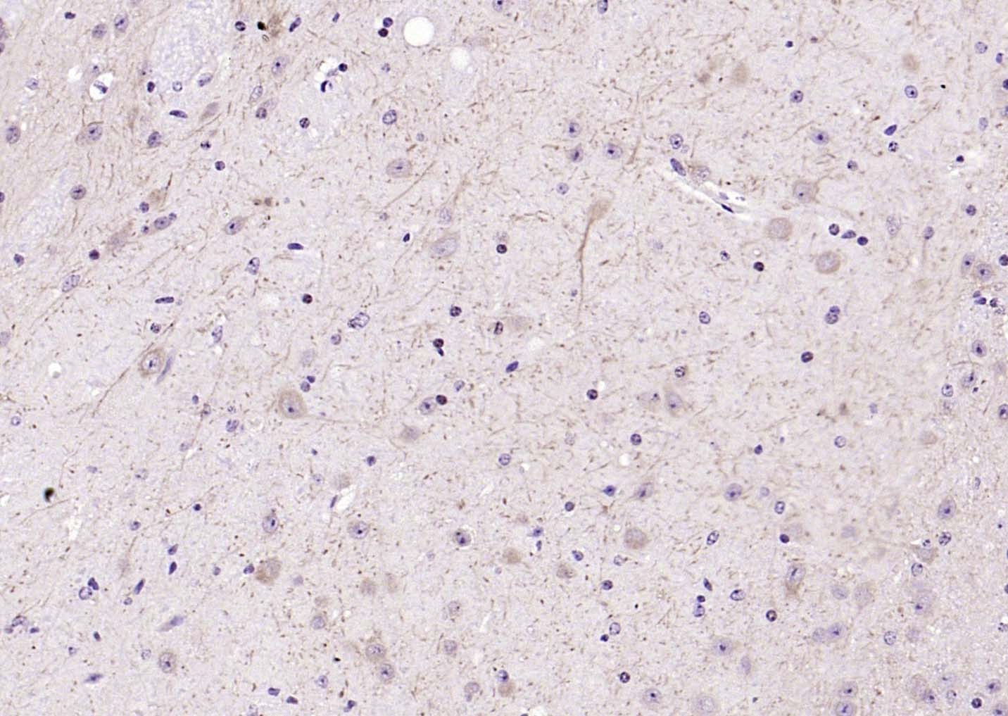Anti-LATS2 Polyclonal Antibody