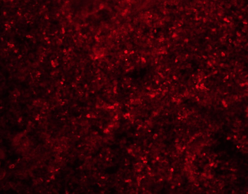 Anti-Lp-PLA2/PLA2G7 Polyclonal Antibody