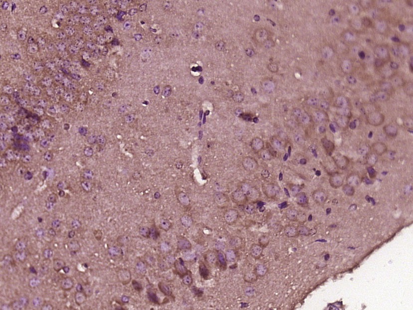Anti-Lipoyl synthase Polyclonal Antibody