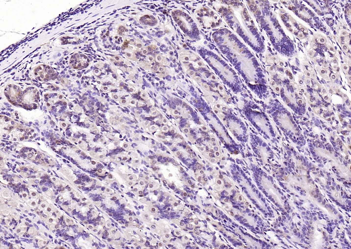 Anti-LATS2 Polyclonal Antibody