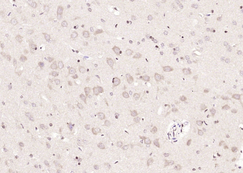 Anti-METTL3 Polyclonal Antibody