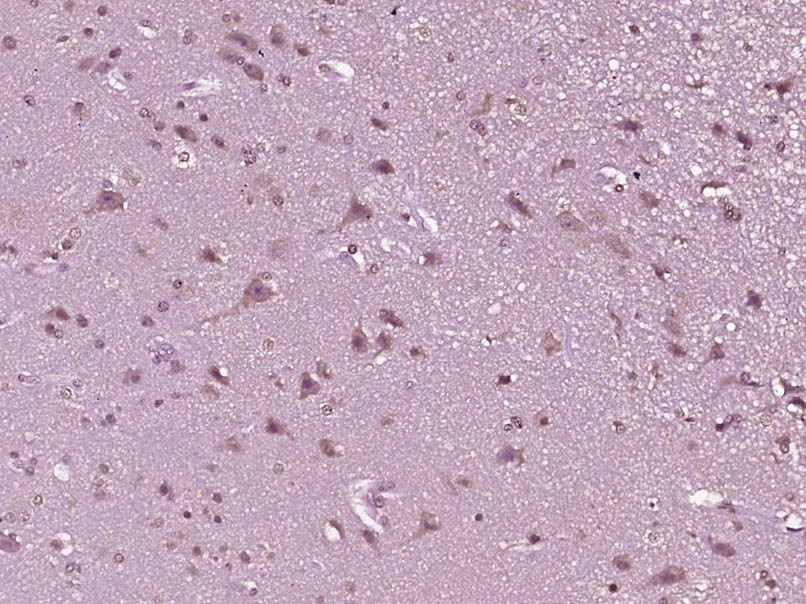 Anti-MDM2 Polyclonal Antibody