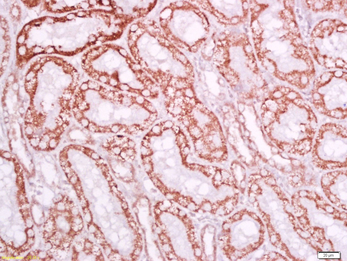 Anti-LY6A Polyclonal Antibody