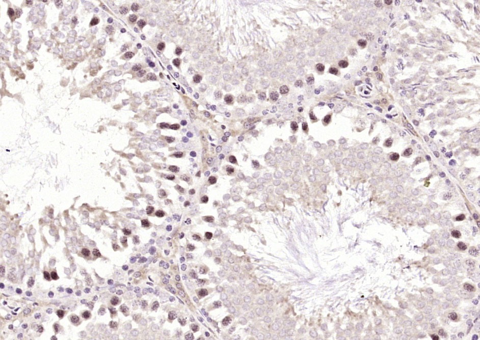 Anti-METTL3 Polyclonal Antibody