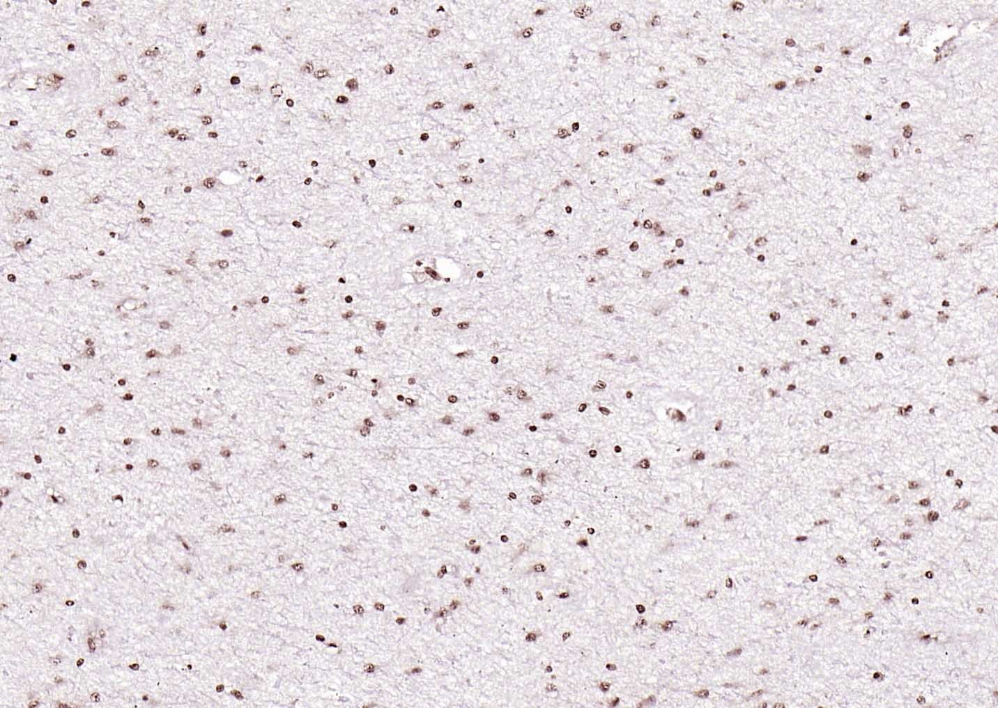 Anti-LATS2 Polyclonal Antibody