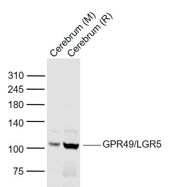 Anti-LGR-5 Polyclonal Antibody 2