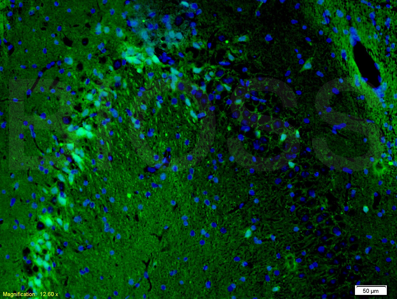 Anti-MAP2 Polyclonal Antibody