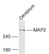 Anti-MAP2 Polyclonal Antibody