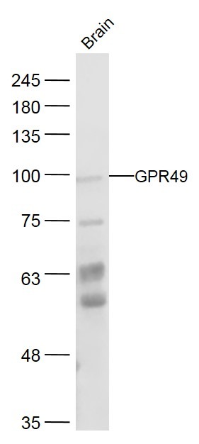 Anti-LGR-5 Polyclonal Antibody