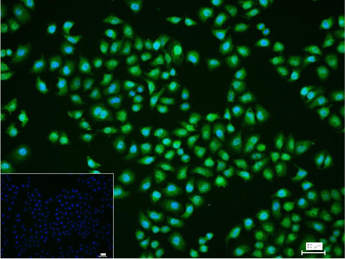 Anti-MAPK14 Polyclonal Antibody