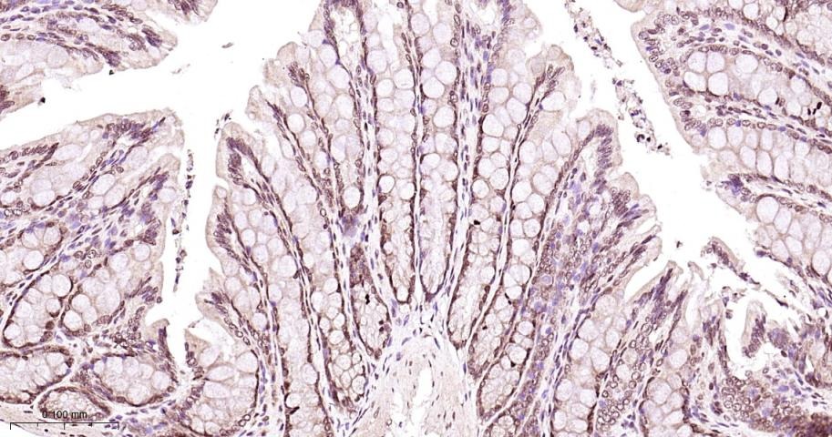 Anti-MAPK14 Polyclonal Antibody 2