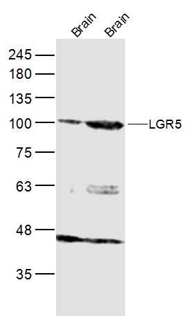 Anti-LGR-5 Polyclonal Antibody 3