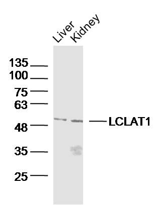 Anti-LCLAT1 Polyclonal Antibody