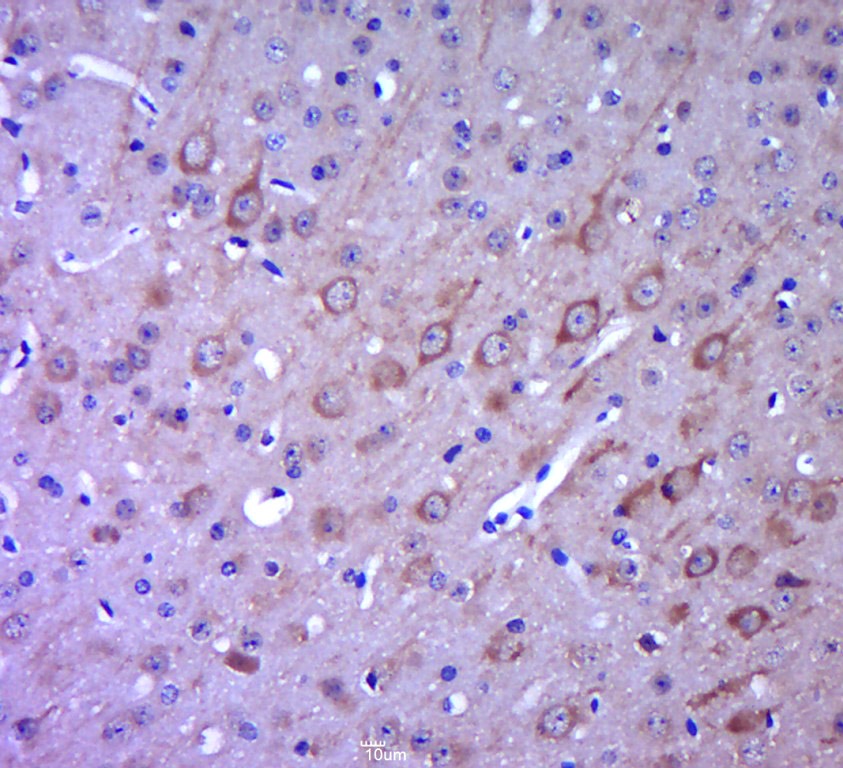 Anti-LGR-5 Polyclonal Antibody 2