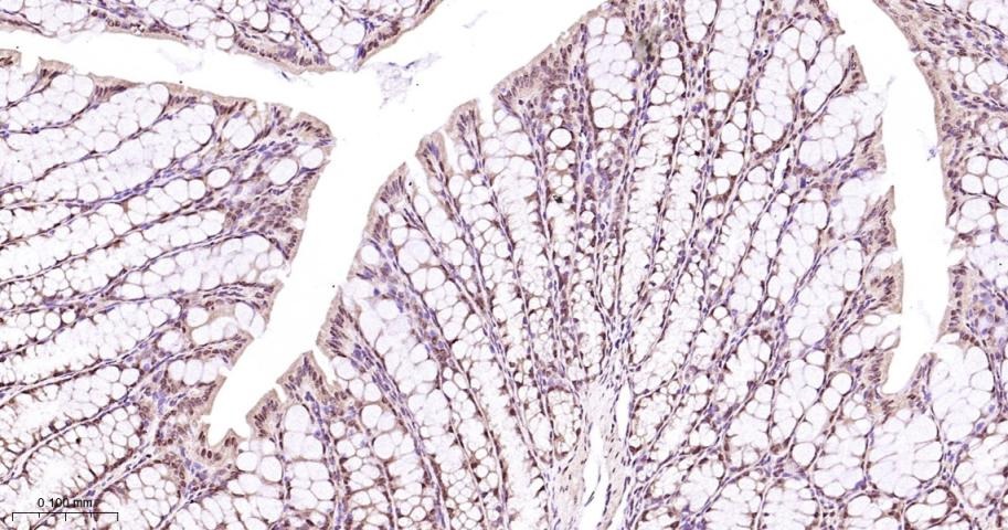 Anti-MAPK14 Polyclonal Antibody 2