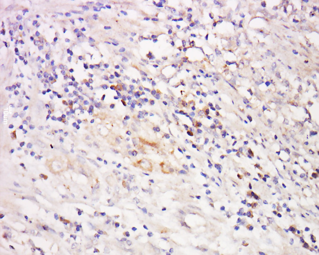 Anti-MAP3K14 Polyclonal Antibody