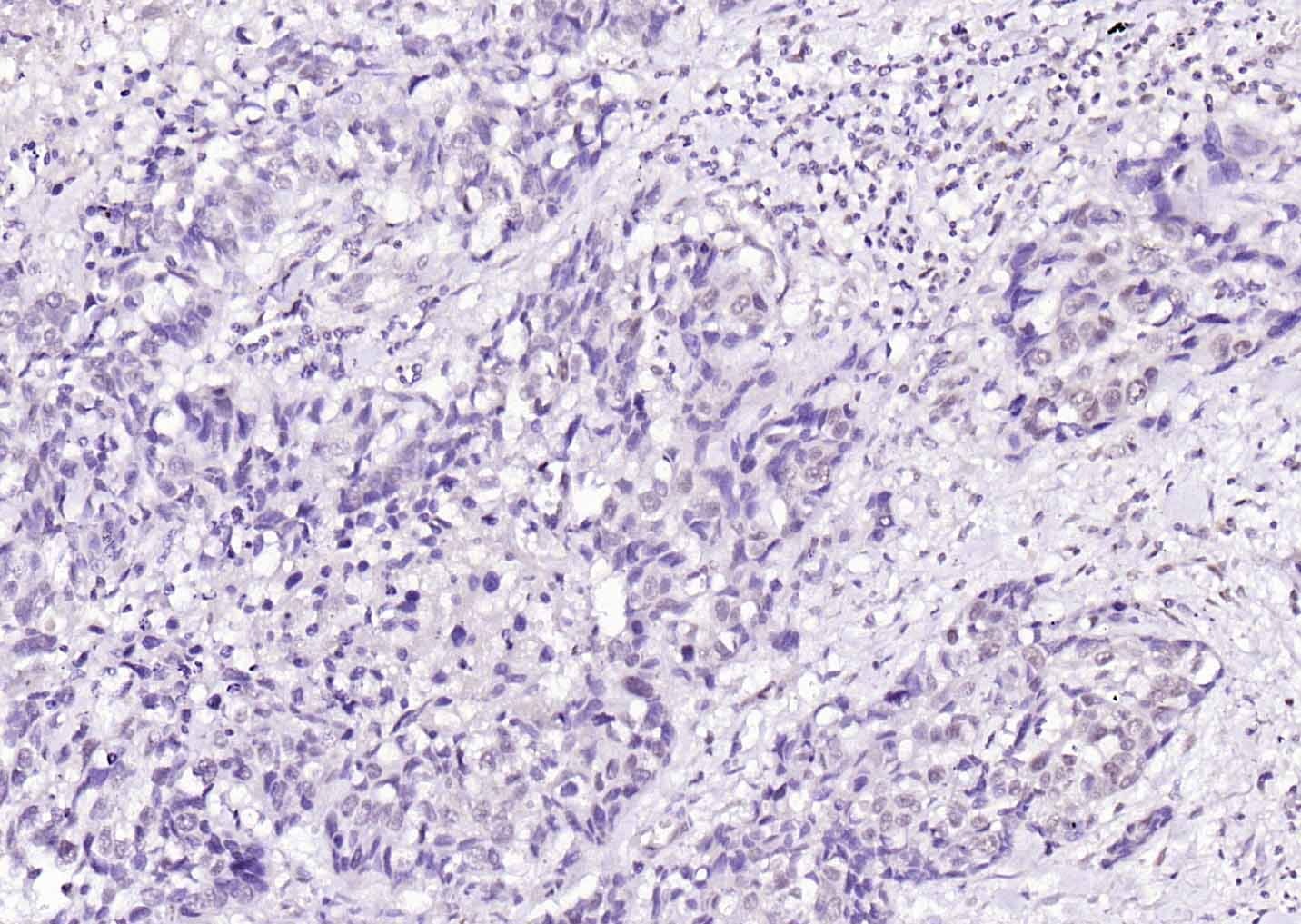 Anti-LATS2 Polyclonal Antibody