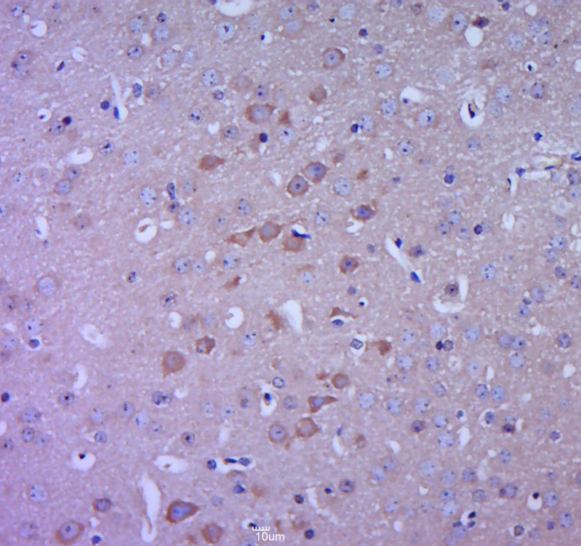 Anti-LGR-5 Polyclonal Antibody 3