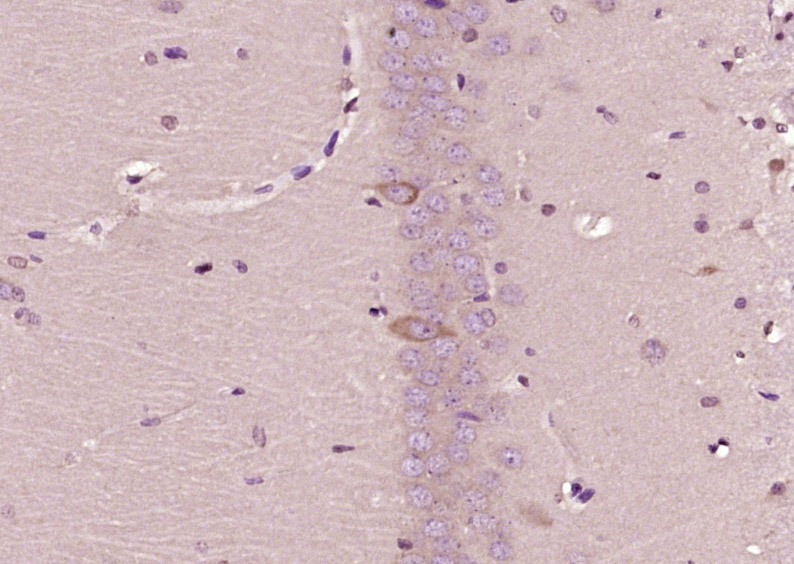 Anti-Leptin Receptor Polyclonal Antibody 2