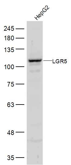 Anti-LGR-5 Polyclonal Antibody 2