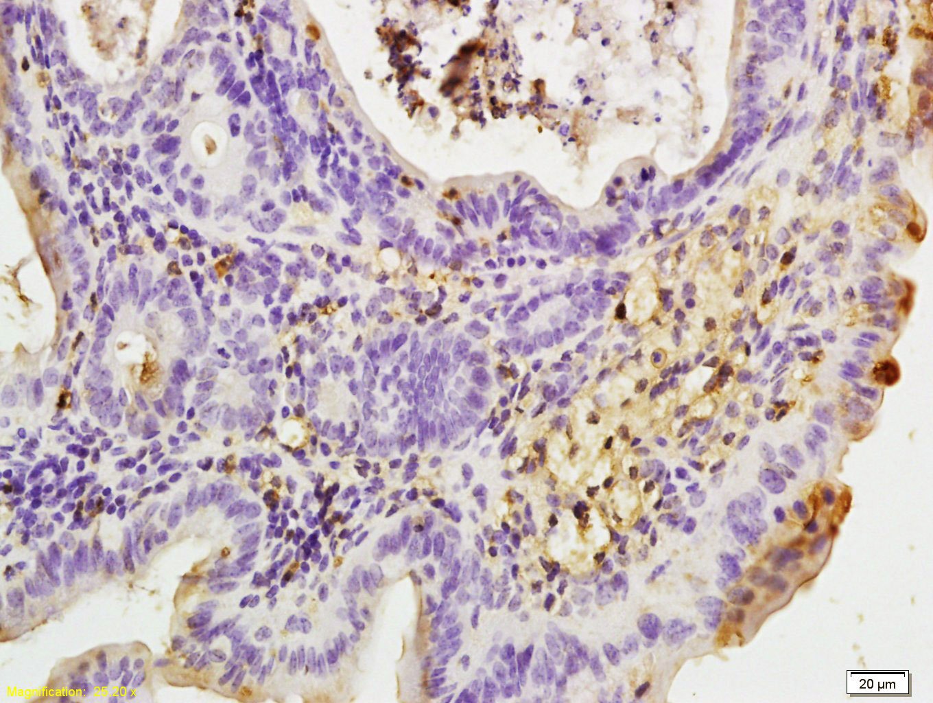 Anti-Leptin Receptor Polyclonal Antibody 2