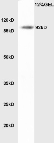 Anti-LDLR Polyclonal Antibody