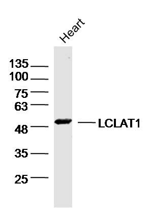 Anti-LCLAT1 Polyclonal Antibody