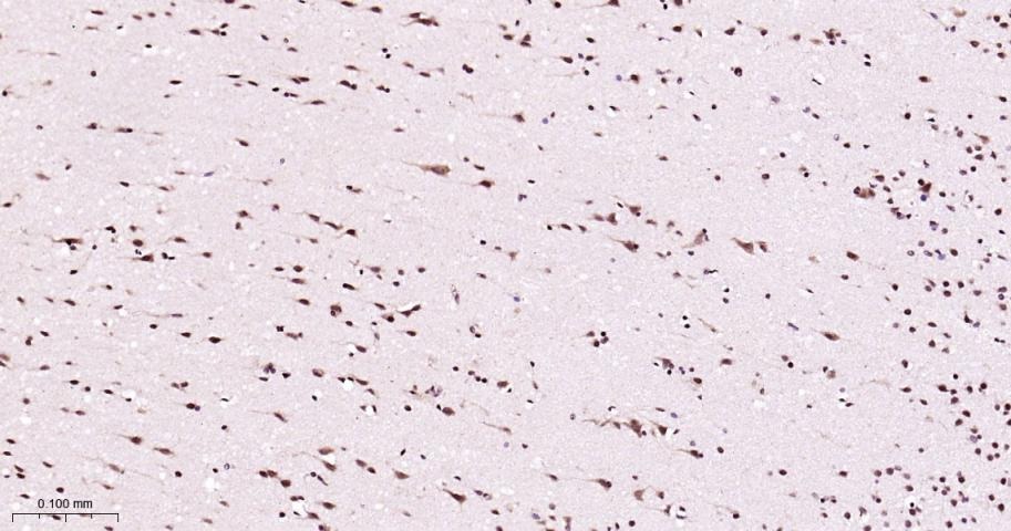 Anti-MAPK14 Polyclonal Antibody 2