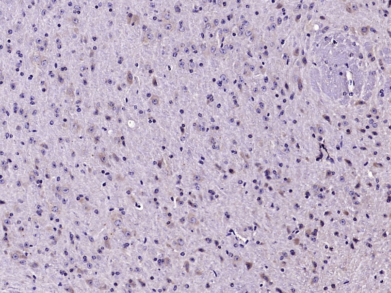 Anti-LC3B Polyclonal Antibody