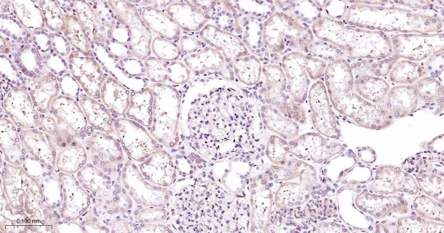Anti-MAPK14 Polyclonal Antibody 2