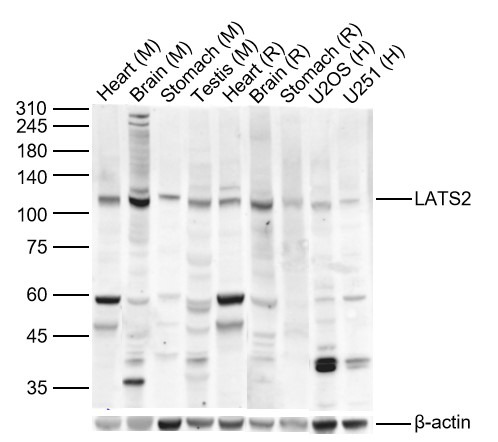 Anti-LATS2 Polyclonal Antibody