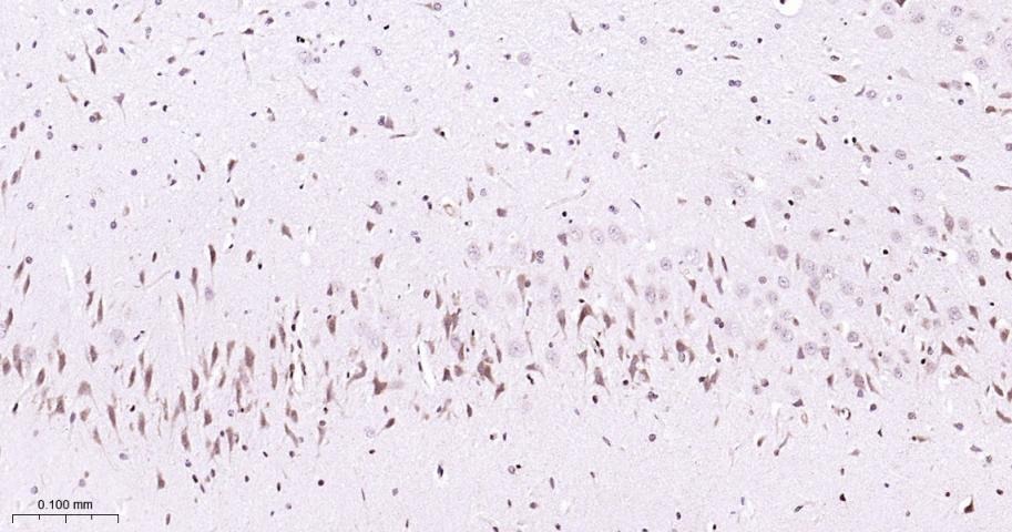 Anti-MAPK14 Polyclonal Antibody 2