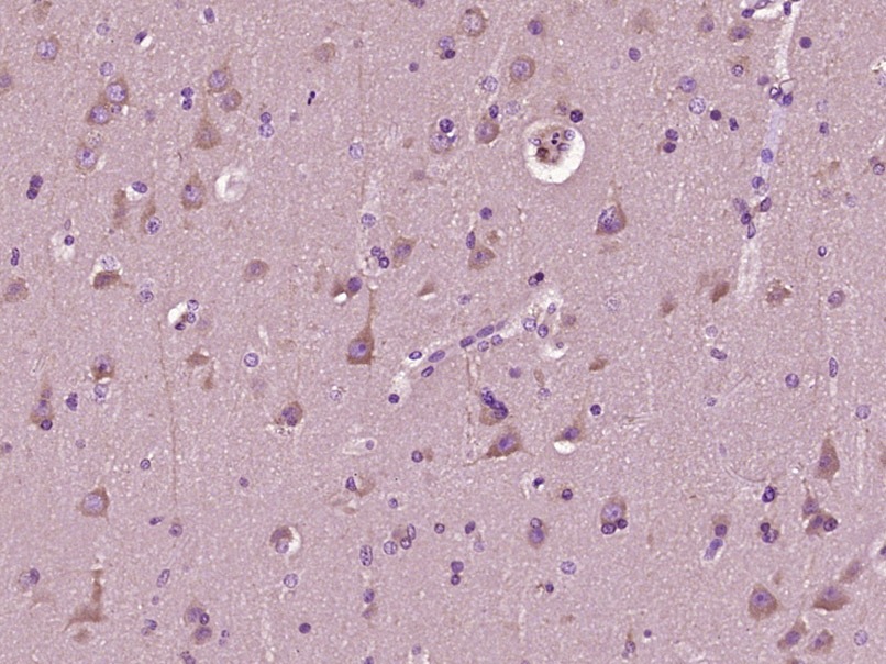 Anti-MAP2 Polyclonal Antibody