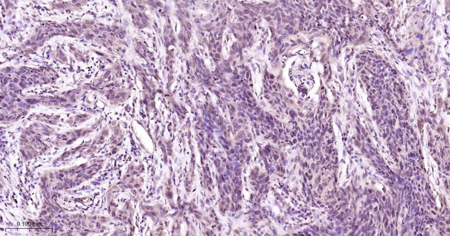 Anti-MAPK14 Polyclonal Antibody 2