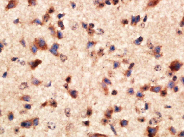 Anti-MMP-2 Polyclonal Antibody