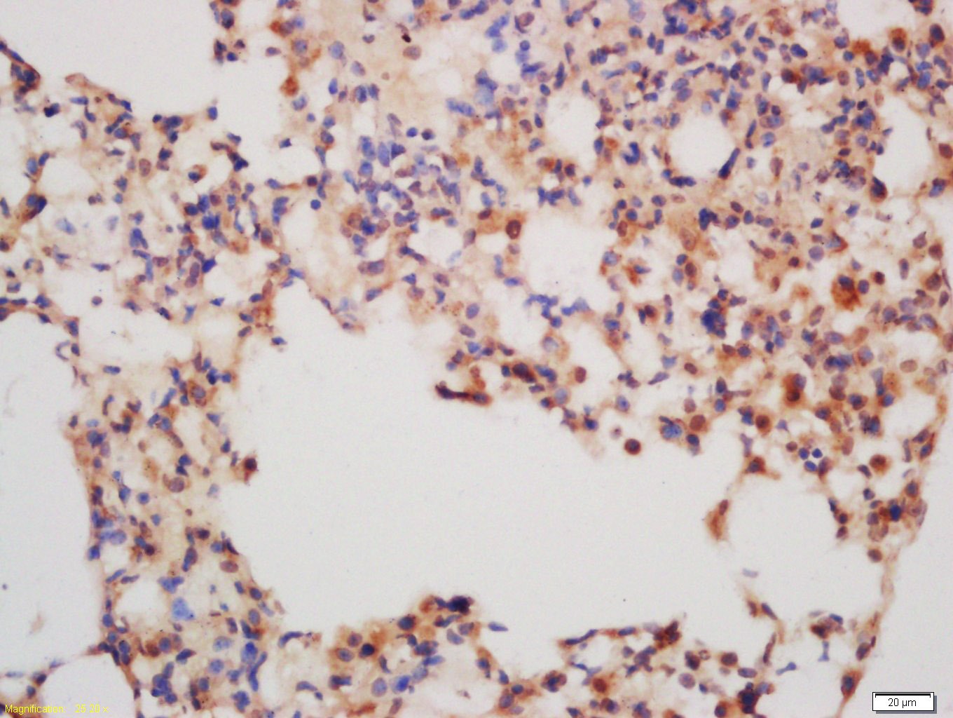 Anti-MMP-13 Polyclonal Antibody 3