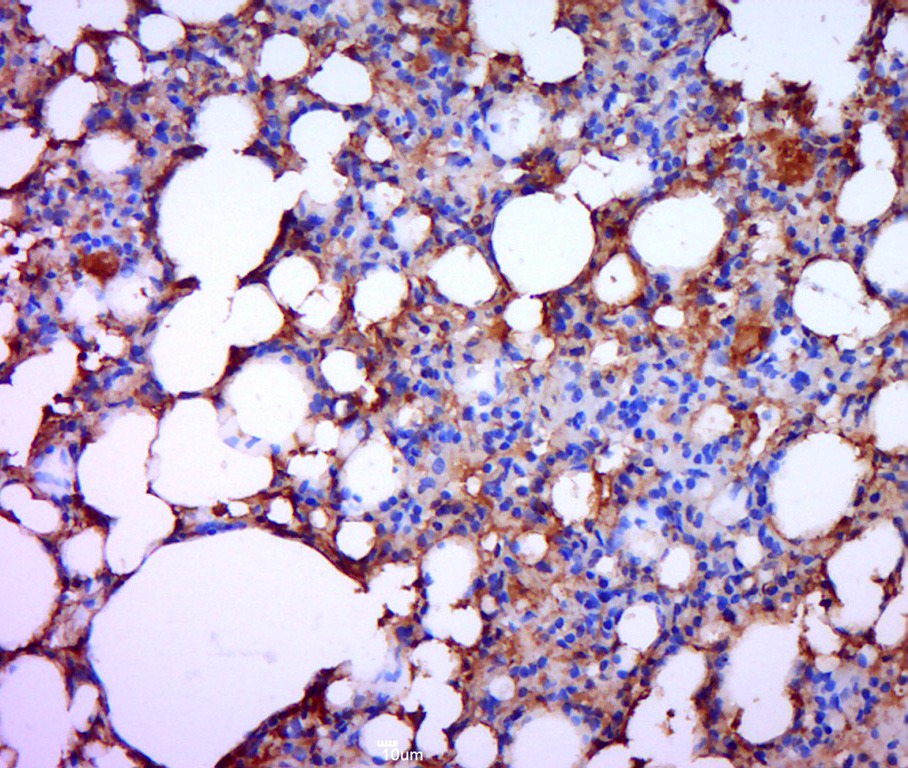 Anti-MMP-13 Polyclonal Antibody 3