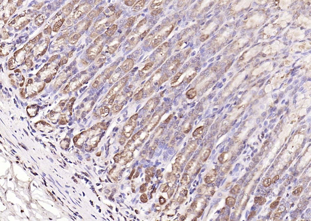 Anti-MMP-1 Polyclonal Antibody 2